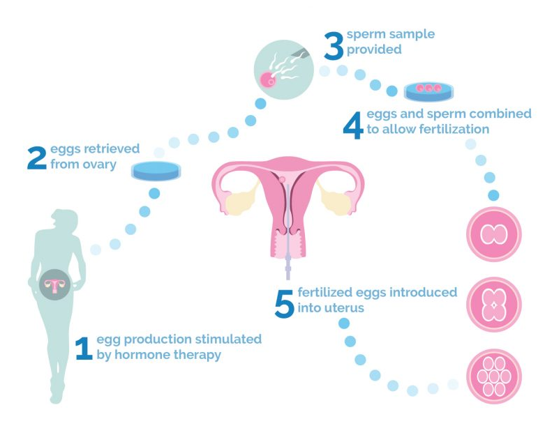 what is test tube baby process