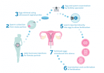 What Is ICSI Treatment and How Is It Different From IVF? | Sincere ...