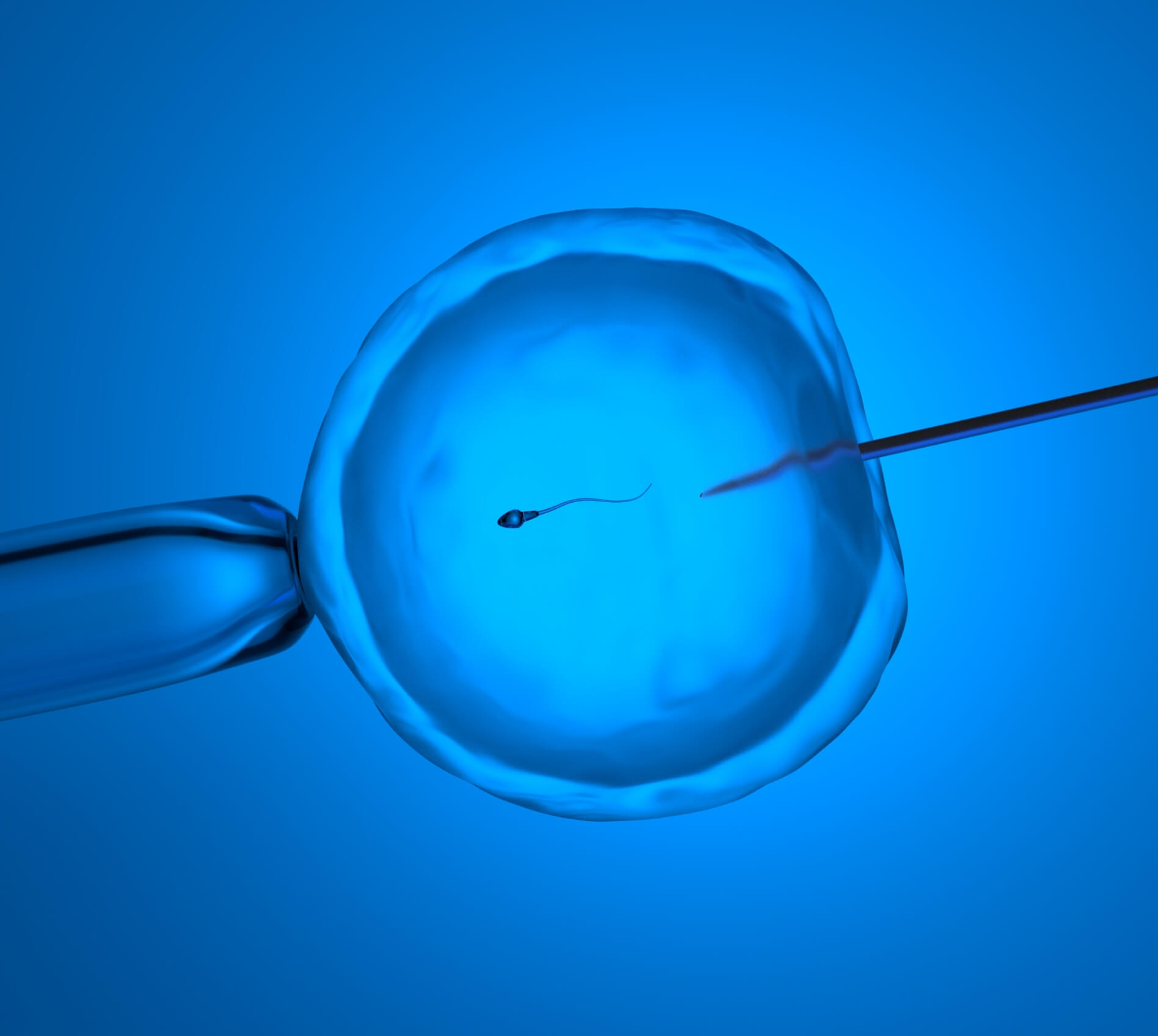 Intracytoplasmic Sperm Injection (ICSi) | Sincere Healthcare Group